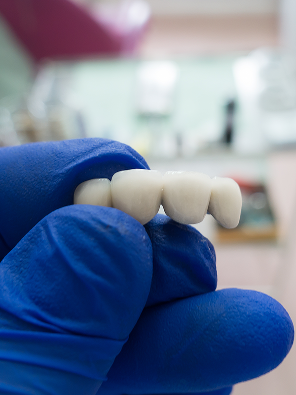 Dental Bridges Woodbridge VA