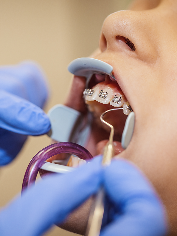 Orthodontics Woodbridge VA