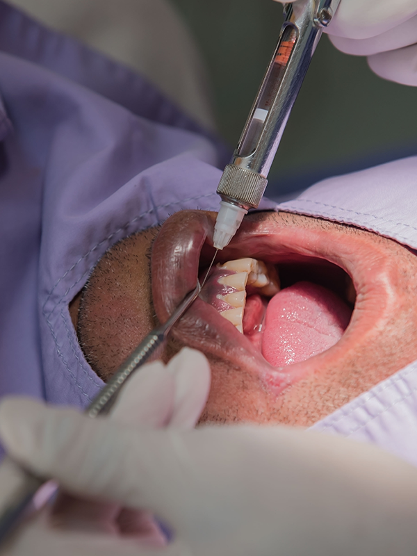 Periodontics Woodbridge VA