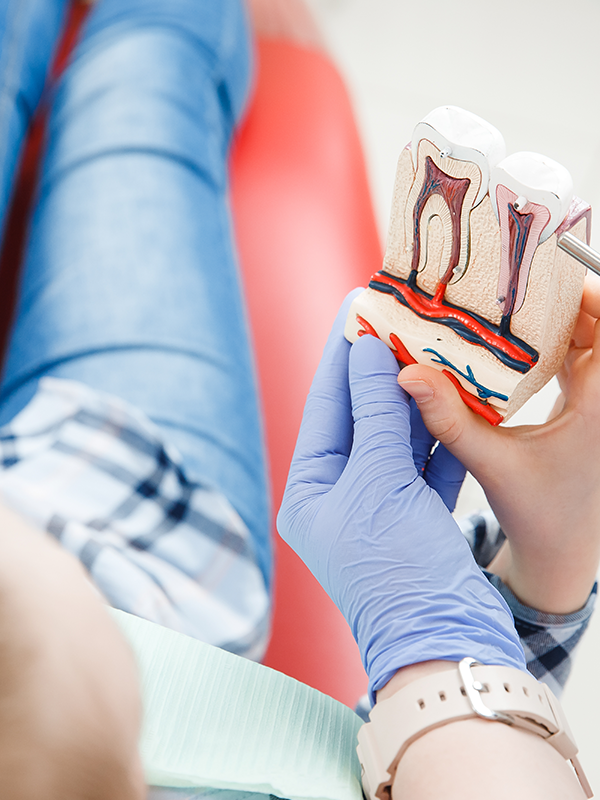 Root Canal Woodbridge VA