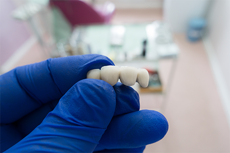 small-dental-bridges