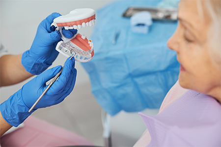 small-dentures