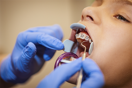 small-orthodontics