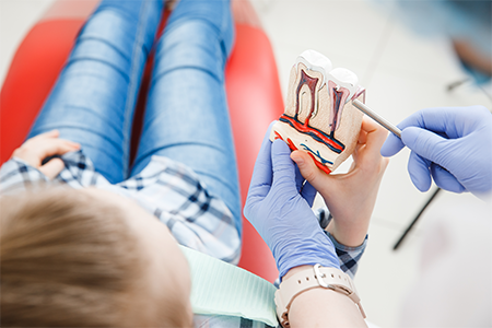 small-root-canals Dental Services Woodbridge VA
