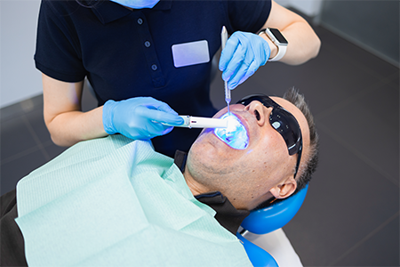 small-teeth-whitening